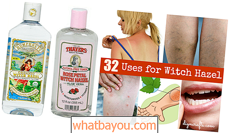 Salud: 32 usos increíbles para Witch Hazel: belleza, salud, cuidado de mascotas y hogar