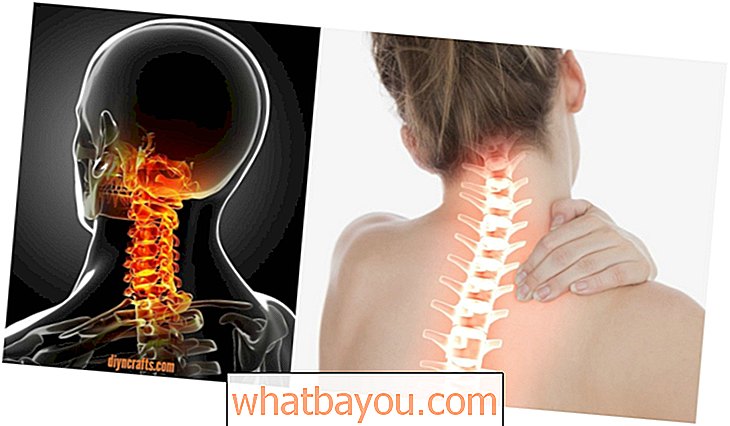 Zdravje: Zdravljenje bolečine v vratu: ta nenavadni raztežaj v 90 sekundah lajša okost vrat!
